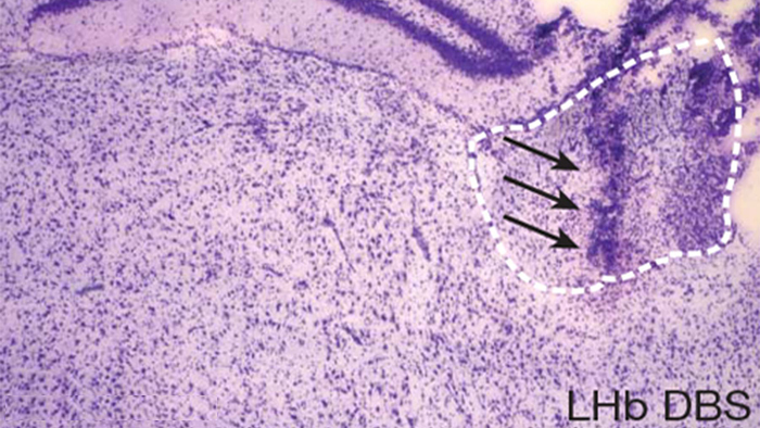 Lateral Habenula image