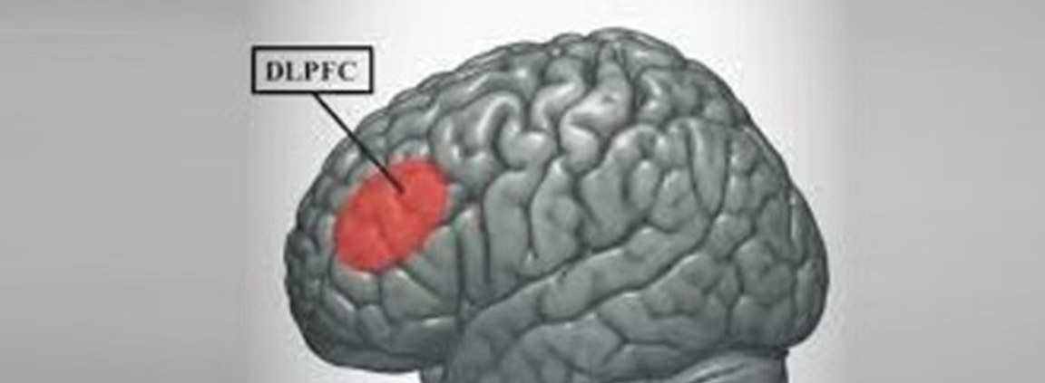 tDCS for Depression and Psychiatric Disorders: What Patients Should Know