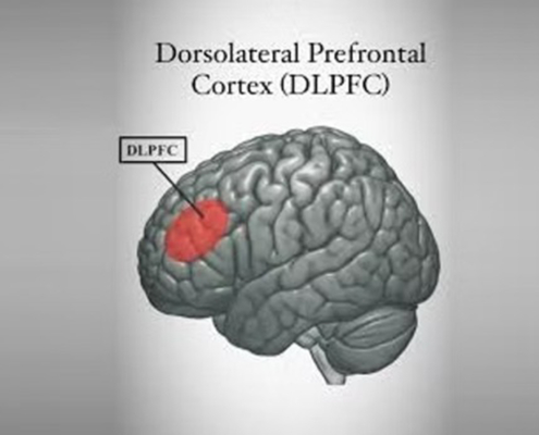 tDCS for Depression and Psychiatric Disorders: What Patients Should Know
