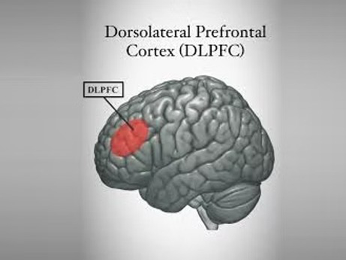 tDCS for Depression and Psychiatric Disorders: What Patients Should Know
