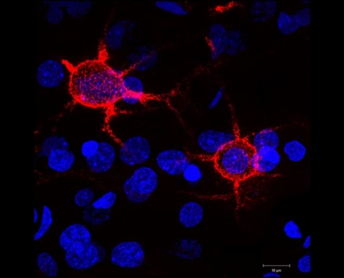How the Aging Brain Processes Touch Differently: New Research on the Somatosensory Cortex