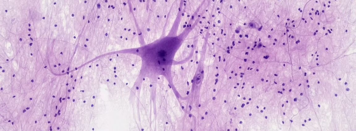 Unlocking the Brain: How the Lateral Habenula Influences Depression and Ketamine Therapy
