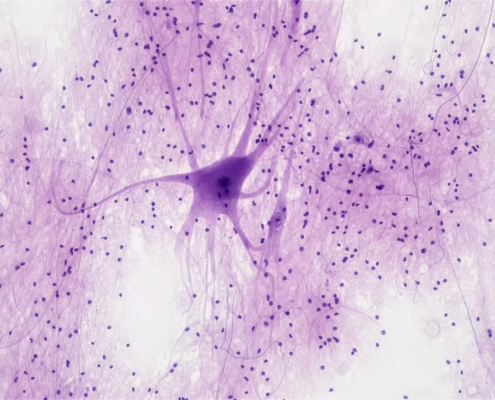Unlocking the Brain: How the Lateral Habenula Influences Depression and Ketamine Therapy