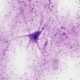 Unlocking the Brain: How the Lateral Habenula Influences Depression and Ketamine Therapy